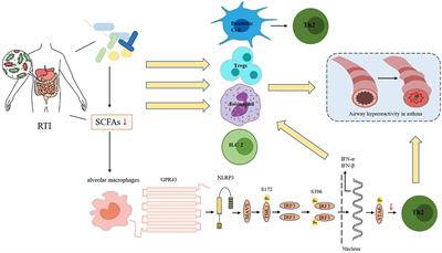 The role of gut microbiome in the complex relationship between respiratory tract infection and asthma